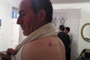 Government, Opposition Using Stones and Knives as Campaign Tools in Lernapat