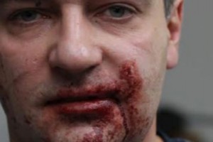 OCCRP Deplores Violence Against OCCRP Reporter