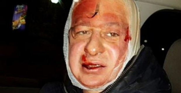 Ukraine: Dozens Of Journalists Assaulted By Police At Protest