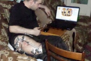 Осужденный, ставший инвалидом вследствие ДТП, просит отсрочить отбывание наказания