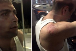 К Вагинаку Шушаняну было применено насилие