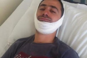 Избивавшие Арсена Тадевосяна полицейские сломали ему челюсть