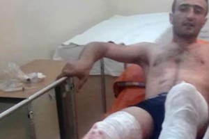Мнацакан Алексанян подал жалобу на полицию