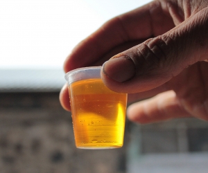 Armenia’s Fantan Village: Famous for Its Oil, Treating Various Illnesses