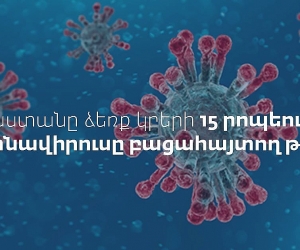 Հայաստանը ձեռք կբերի 15 րոպեում կորոնավիրուսը ախտորոշող թեստեր
