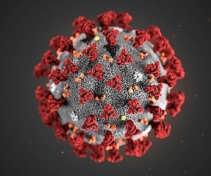 Armenian, Israeli Experts to Hold Coronavirus Video Conference