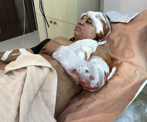 Администрация ЗПЧ Арцаха приступила к сбору фактов