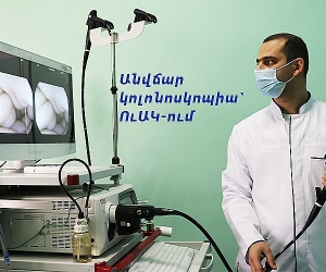 Ուռուցքաբանության ազգային կենտրոնը կանցկացնի անվճար կոլոնոսկոպիա 45 տարեկանից բարձր անձանց համար