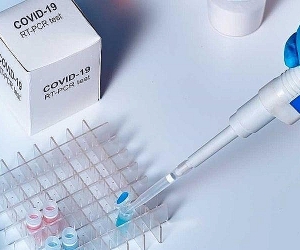 Armenia: 18 Covid-19 Deaths