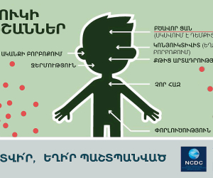 Հայաստանում գրանցվել է կարմրուկի 11 դեպք
