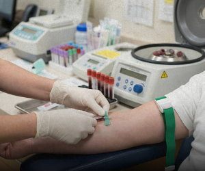 HIV Awareness in Armenia Remains Low: 514 New Cases in 2025